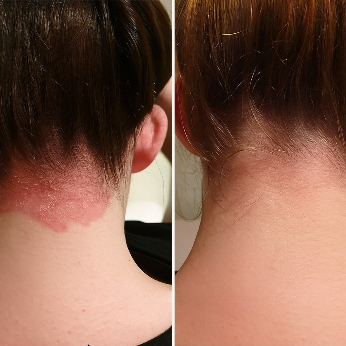 Cepillo Eléctrico Para Crecimiento Cabello